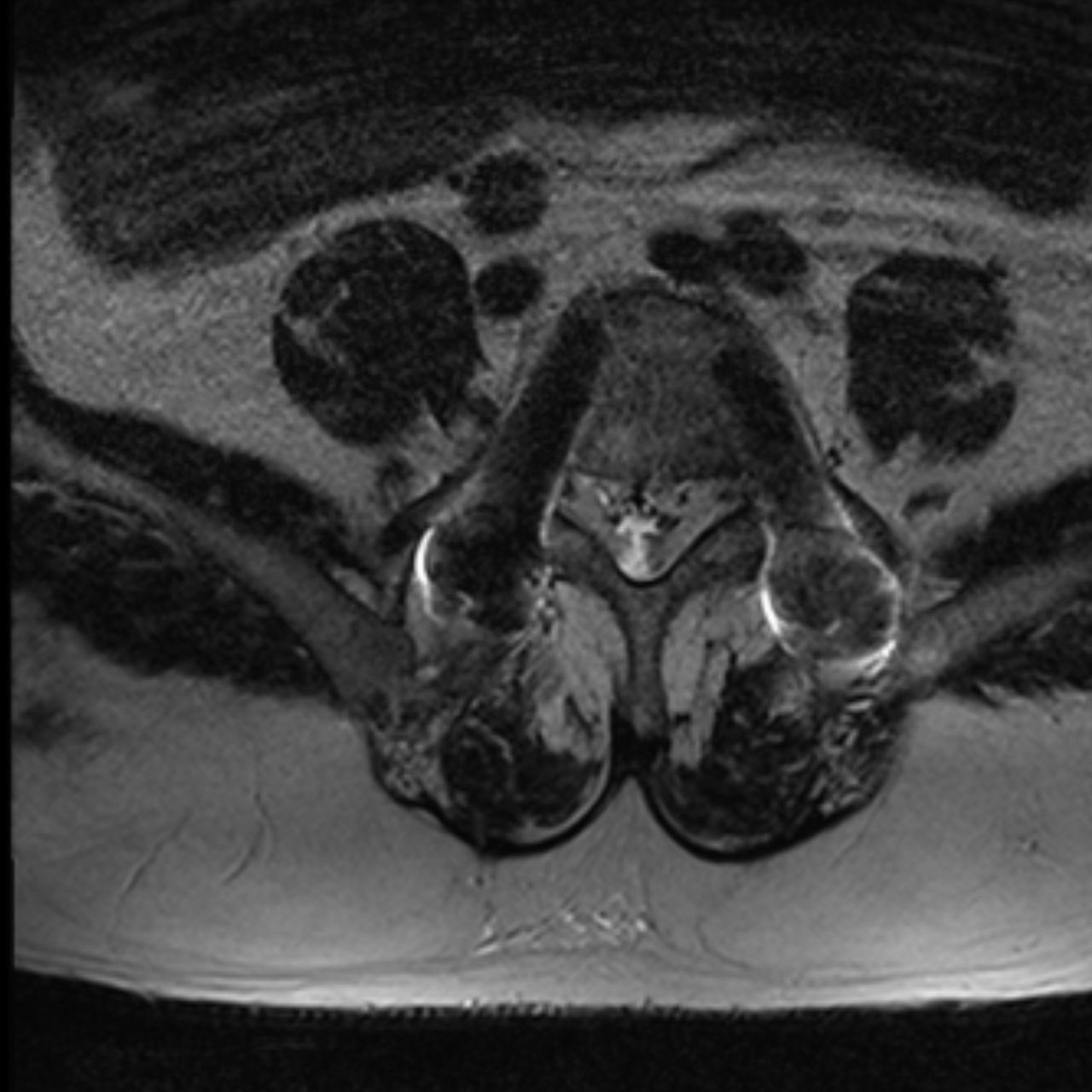 David Tafur Muñoz-1460