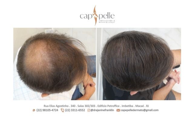 Janine Franklin Machado-3