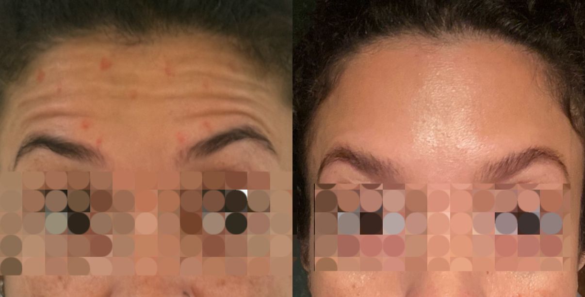 Alana  Meira Silveira Potiguara -0