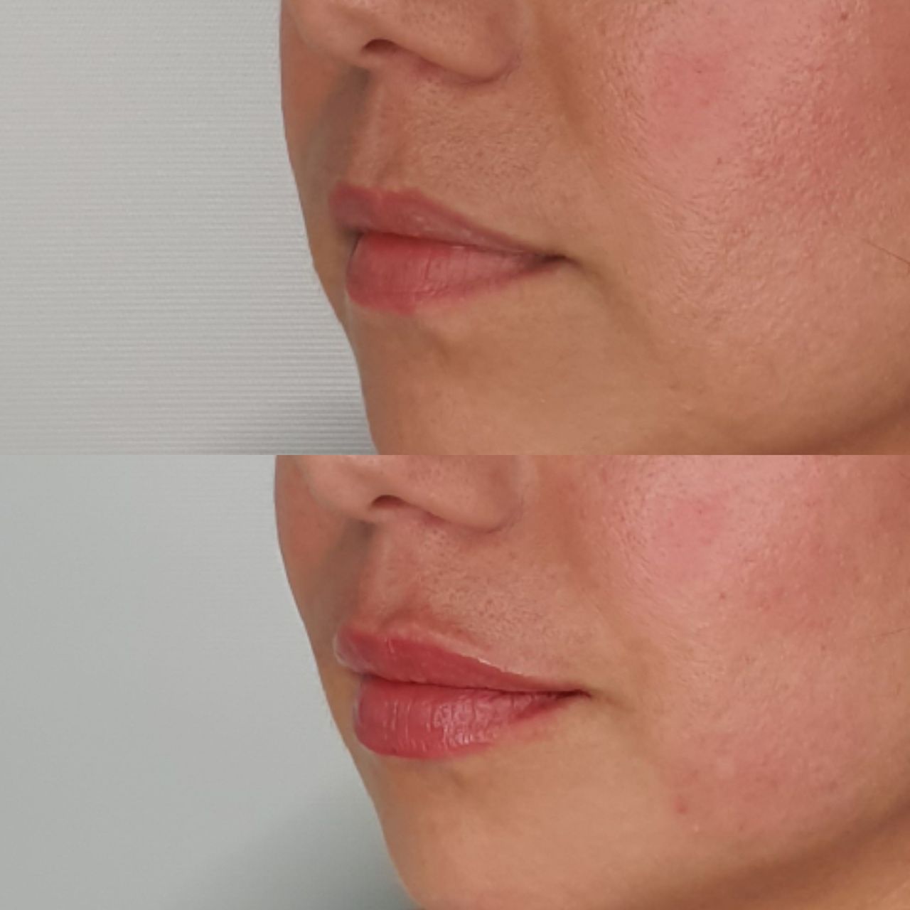 Juan Guillermo Bretón Franco-24