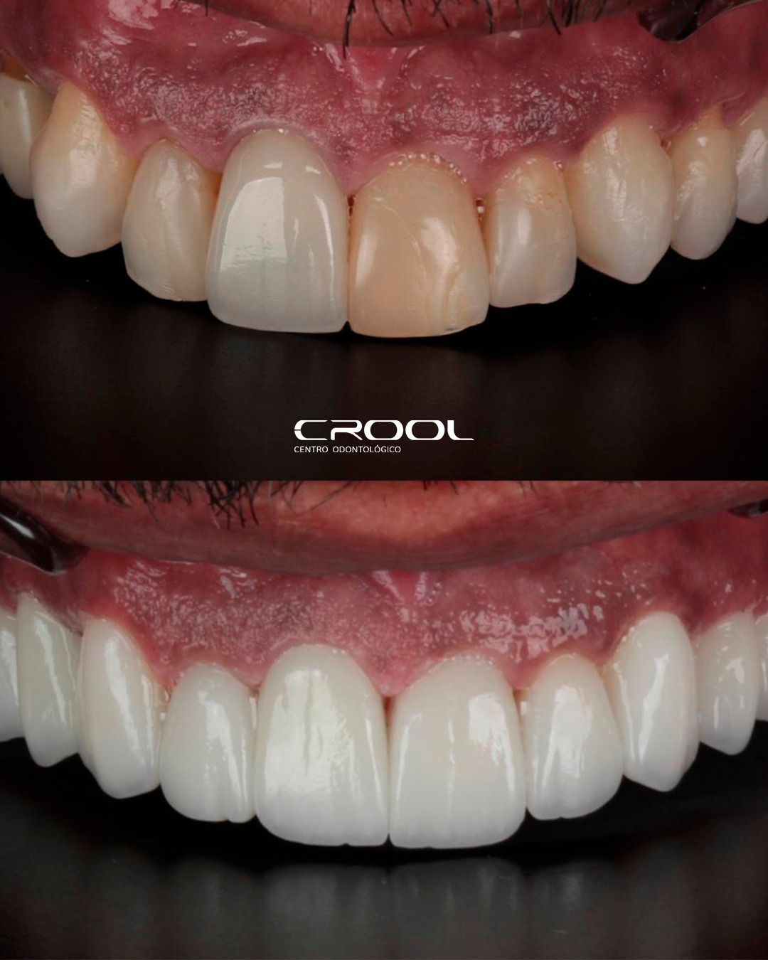 Frederico  Coelho-18