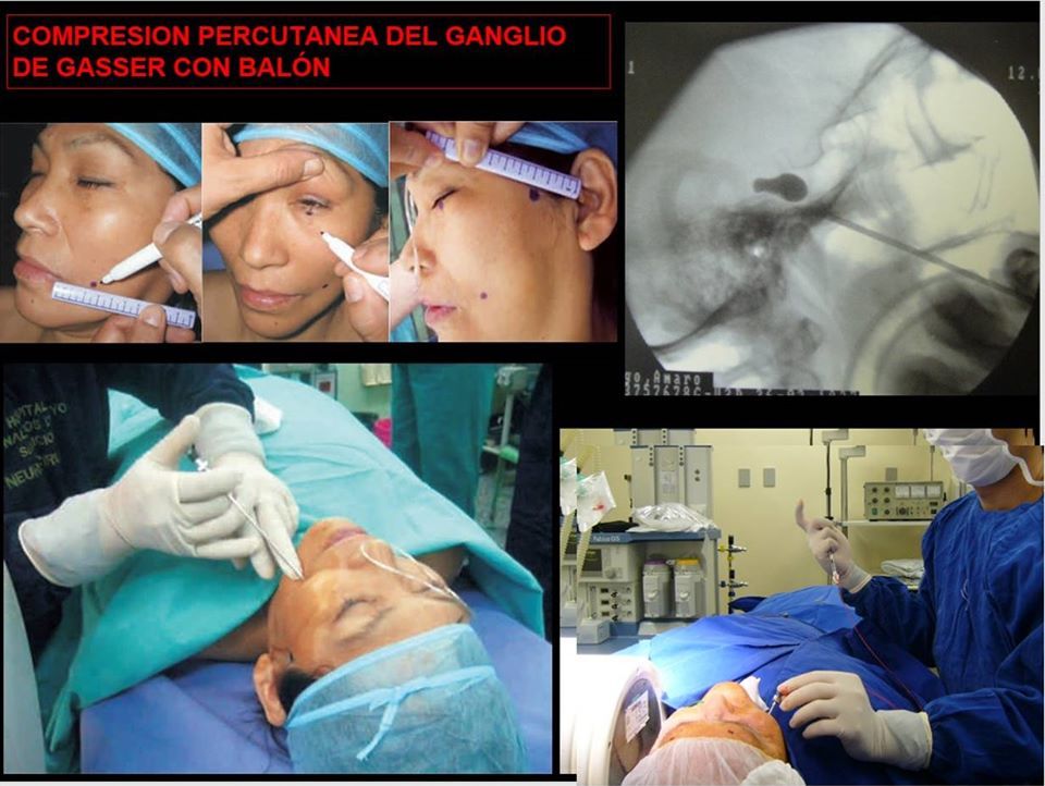 Marco Carlos Gonzales-Portillo Showing-28