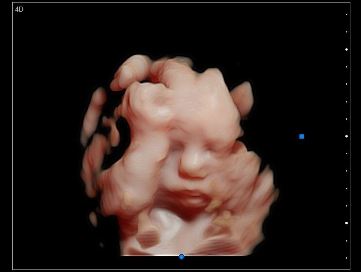 Lady Tatiana Duarte Lopez-10