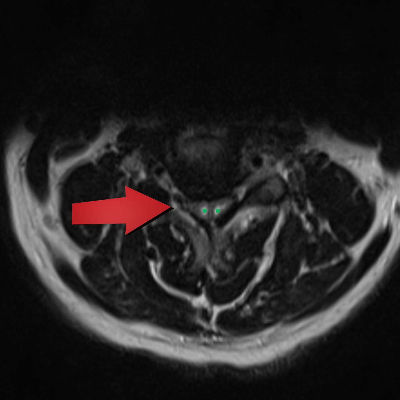 David Tafur Muñoz-1967