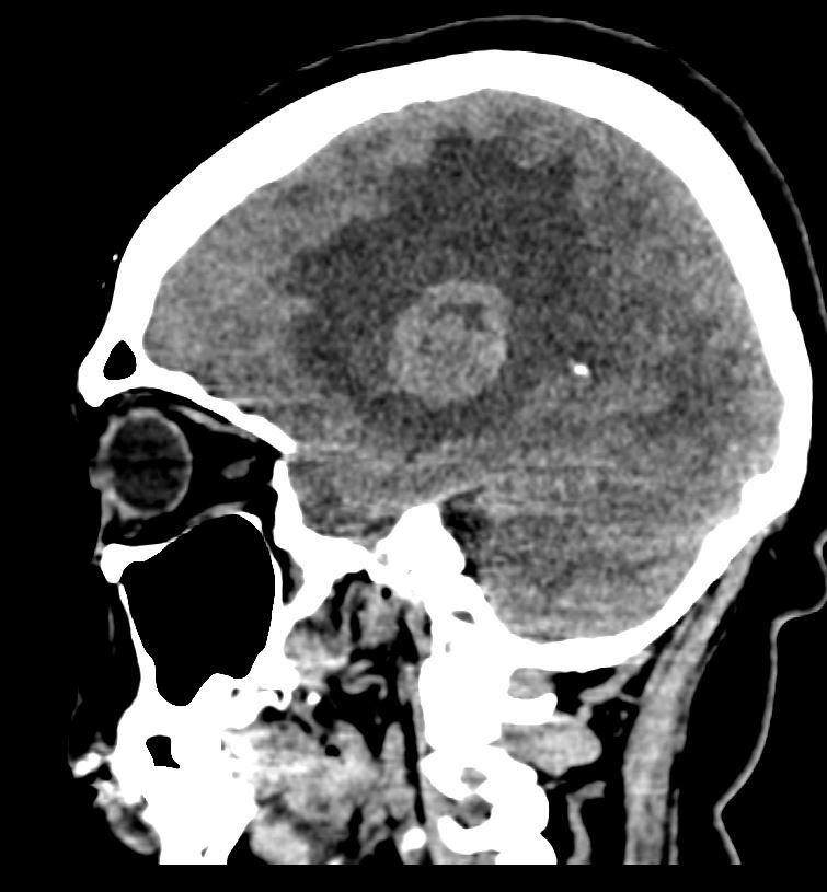 David Tafur Muñoz-1074