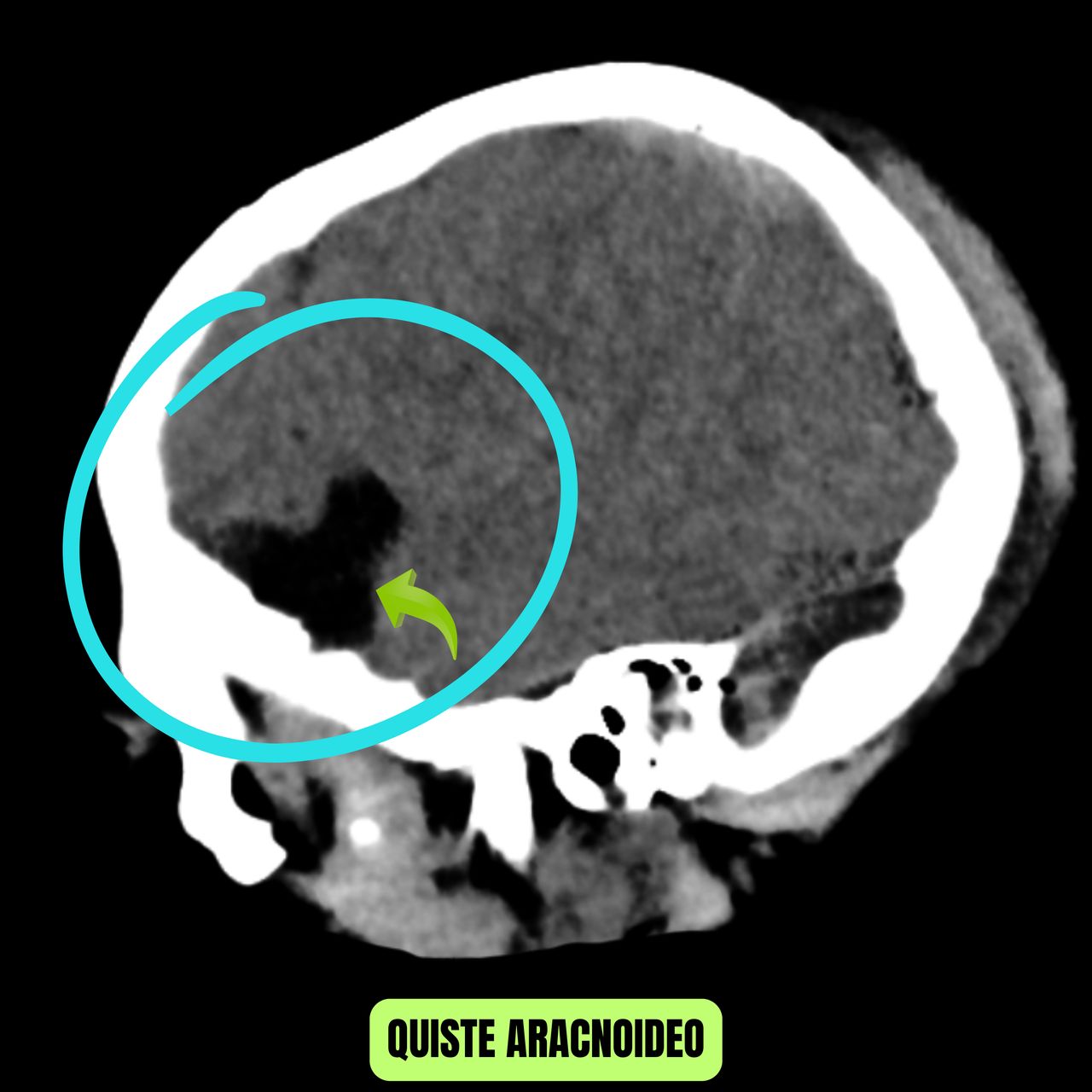 David Tafur Muñoz-1027