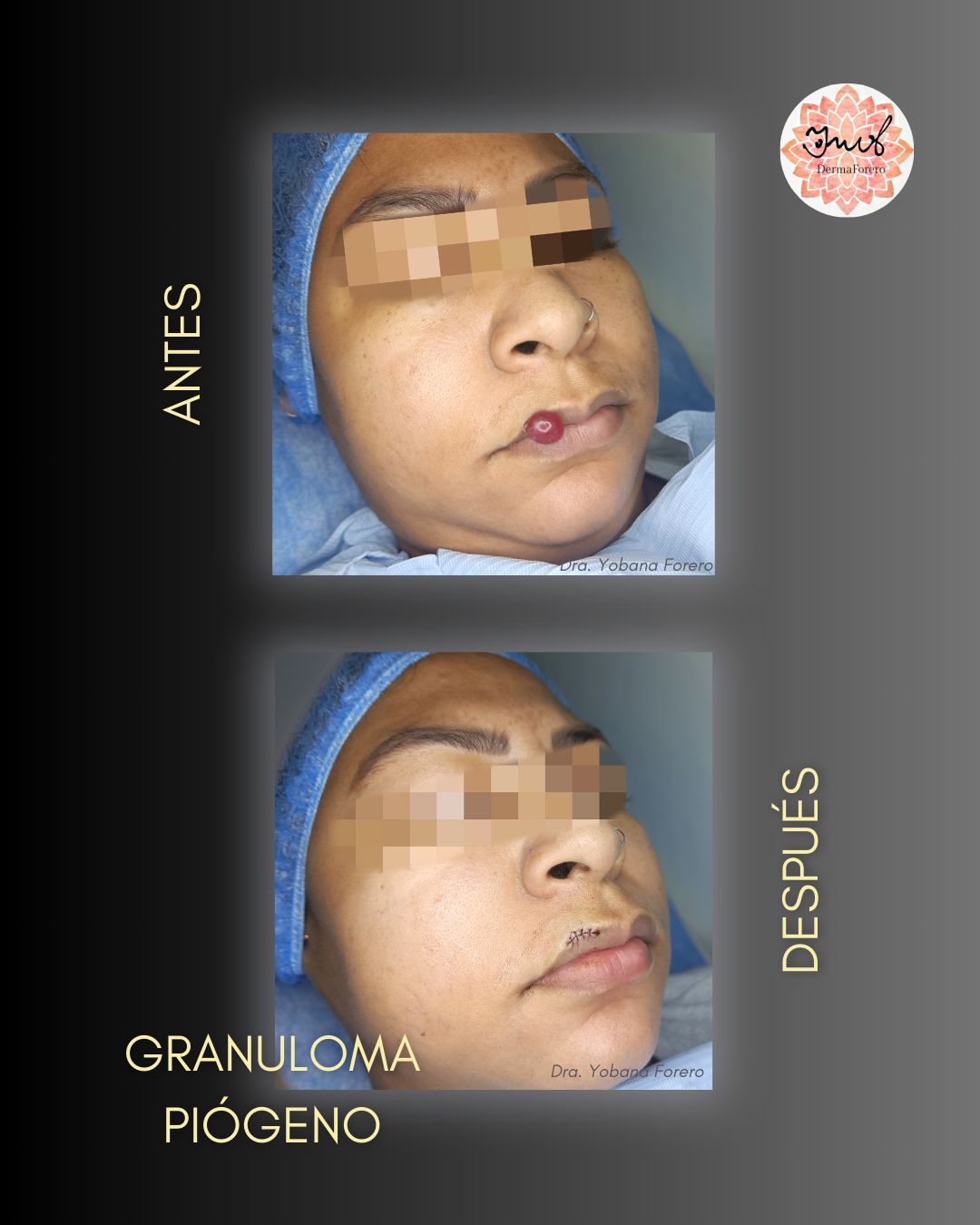 Yobana Carmenza Forero Perdomo-3