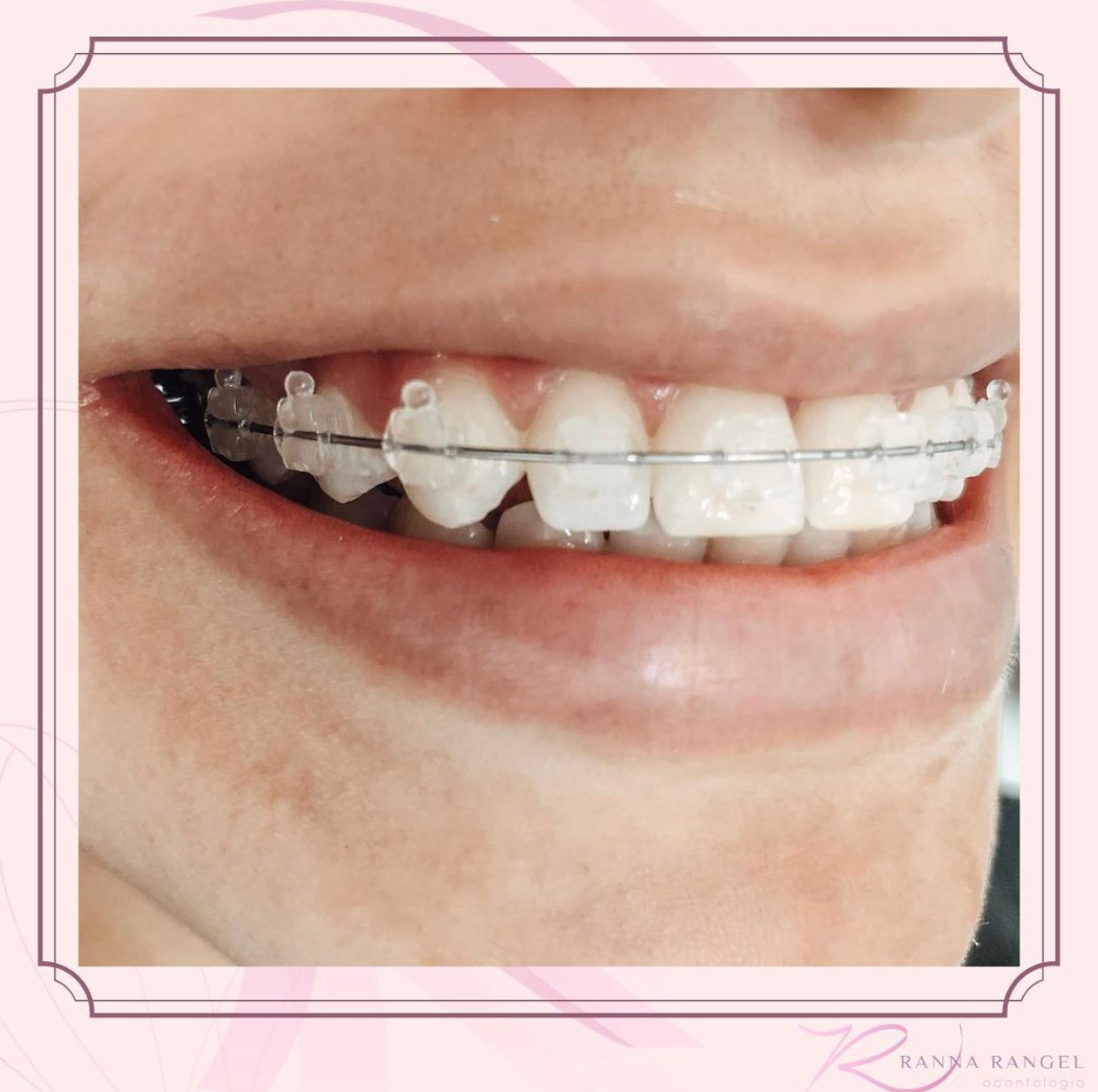 Ranna Rangel Saraiva-2