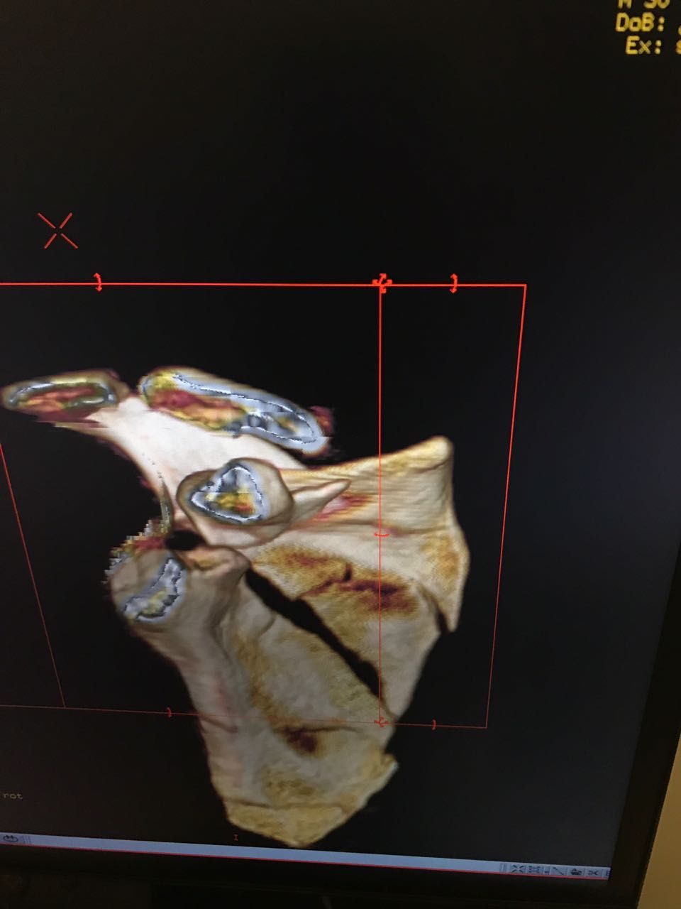 Andres De La Espriella Rosales-46