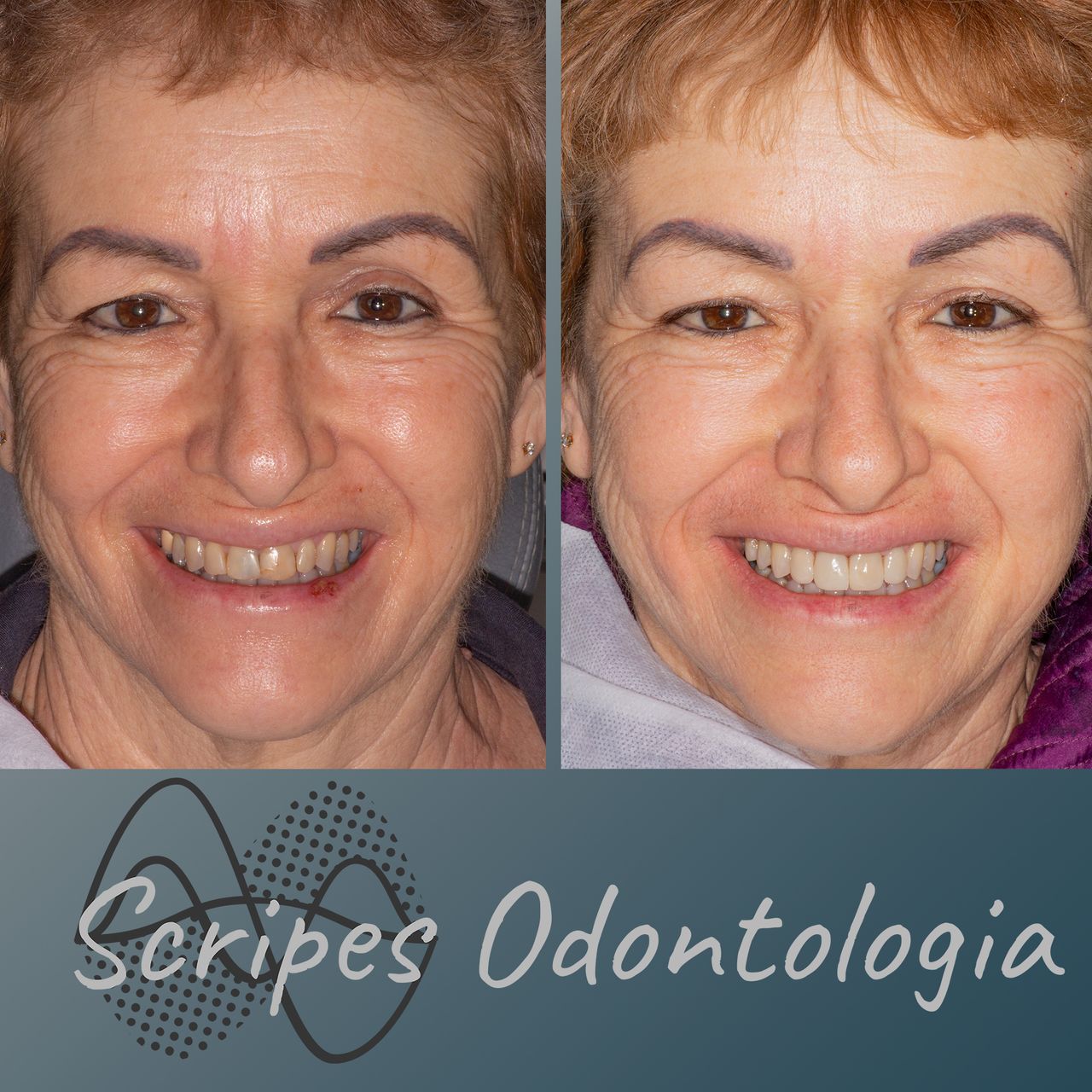 Gabriel Godoy Scripes-68