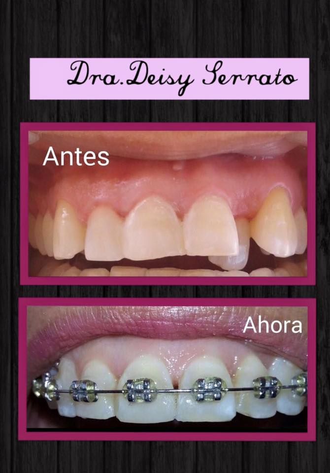 Deisy Serrato Ardila-5