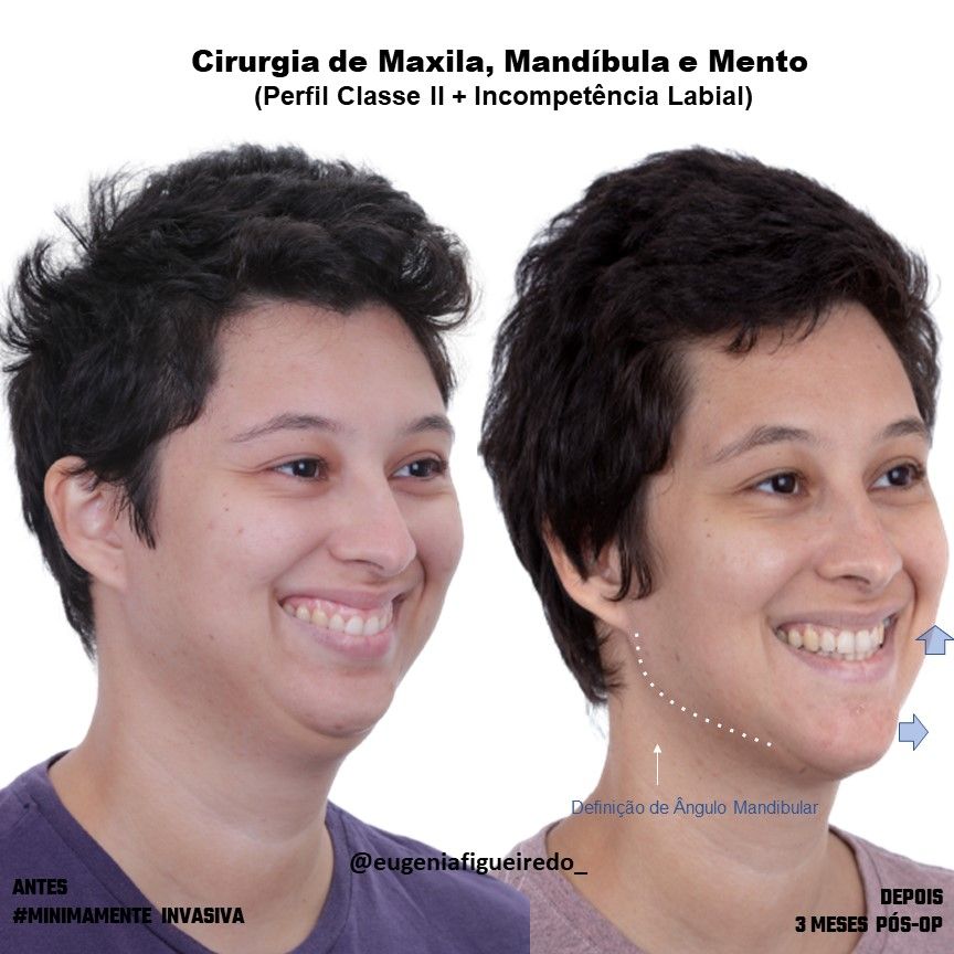 Eugênia Figueiredo-20