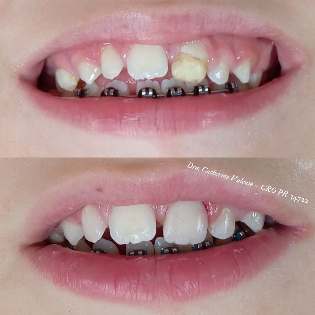 Catherine Ariadne De França  Valente-7