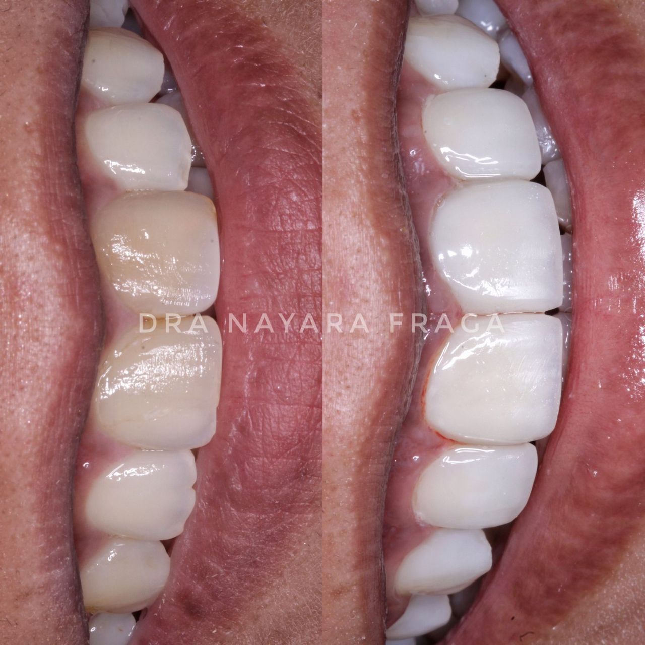 Nayara Fraga De Miranda-9