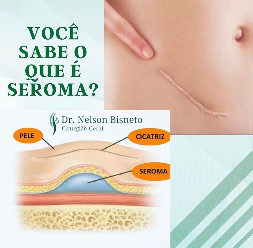Nelson Bisneto-82