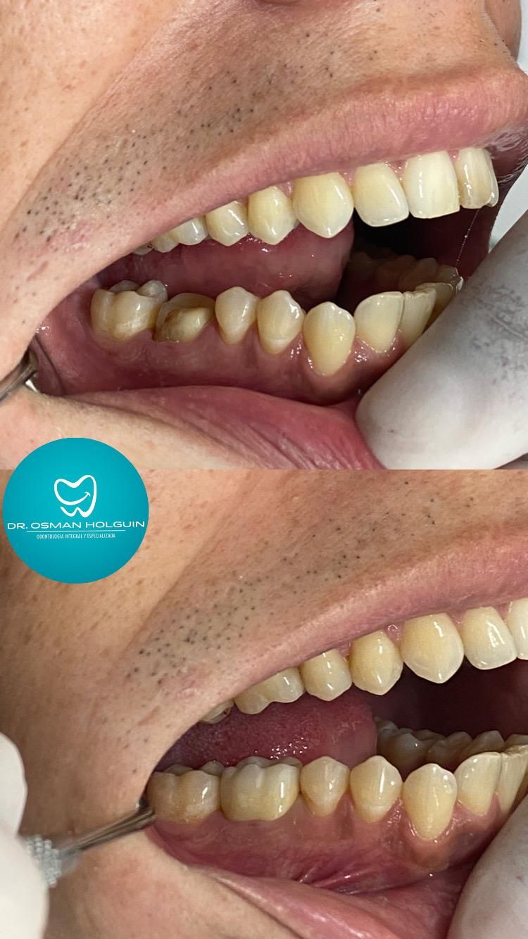 Osman Fernando Holguin Grisales-6