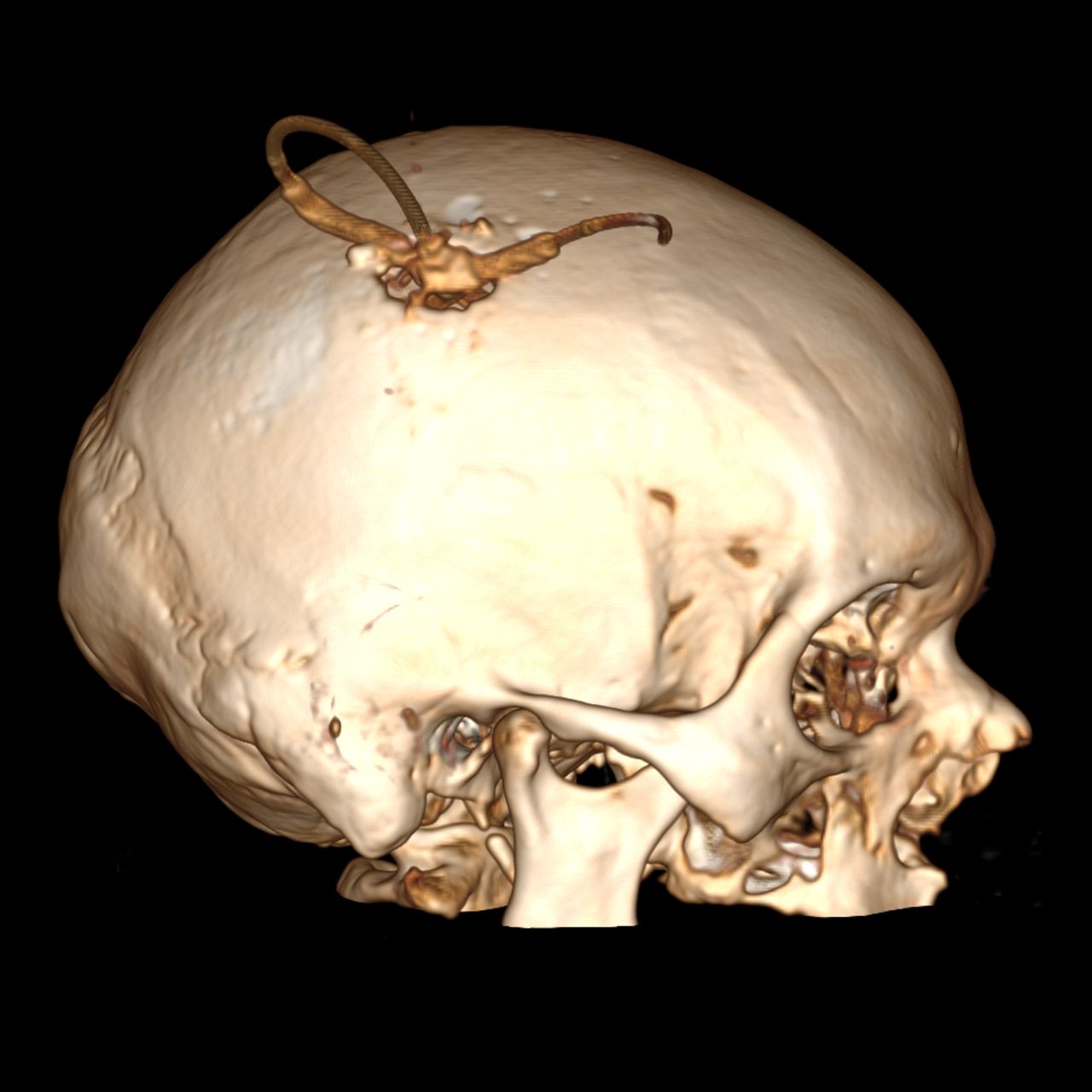 David Tafur Muñoz-1228