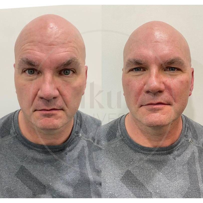 Oscar Iván Lozano Navarrete-16