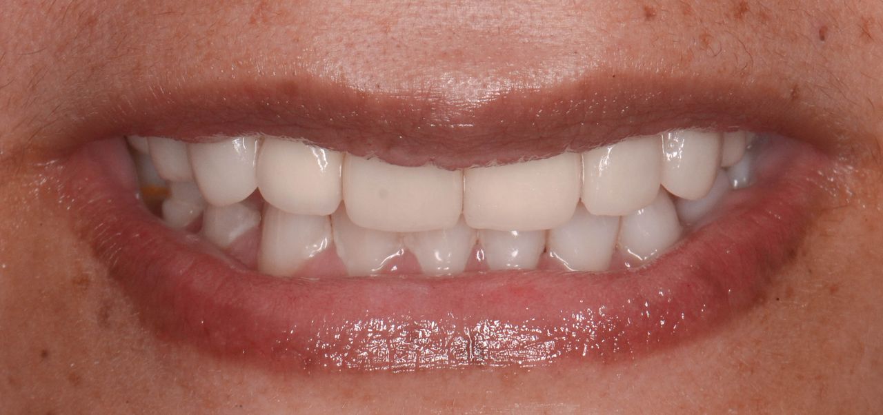 Edith Molina Miranda-12