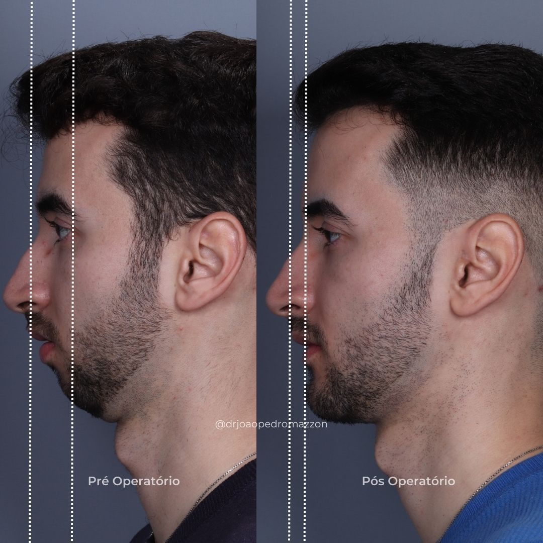 João Pedro Paulino Mazzon-70