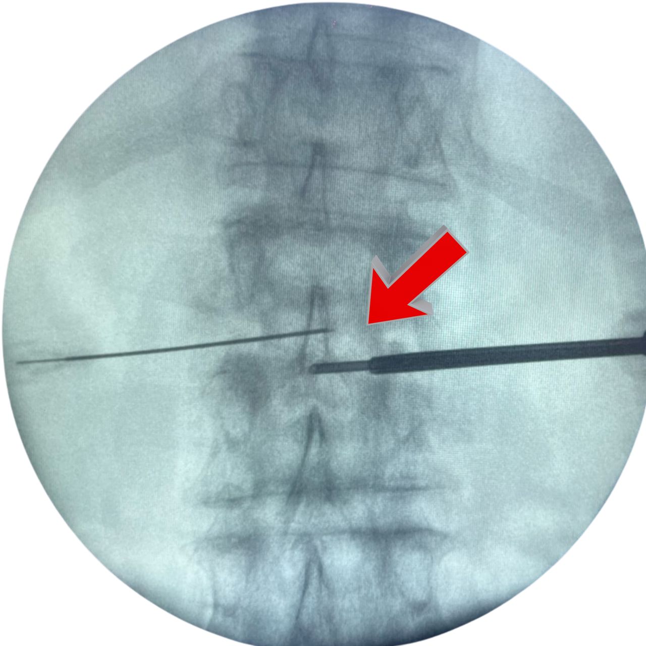 David Tafur Muñoz-1725