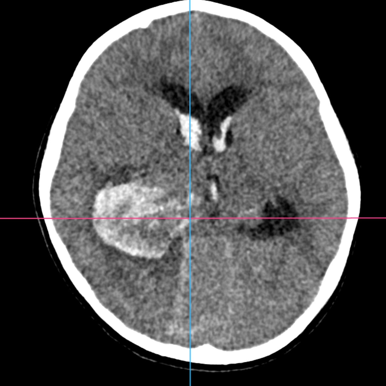 David Tafur Muñoz-1663