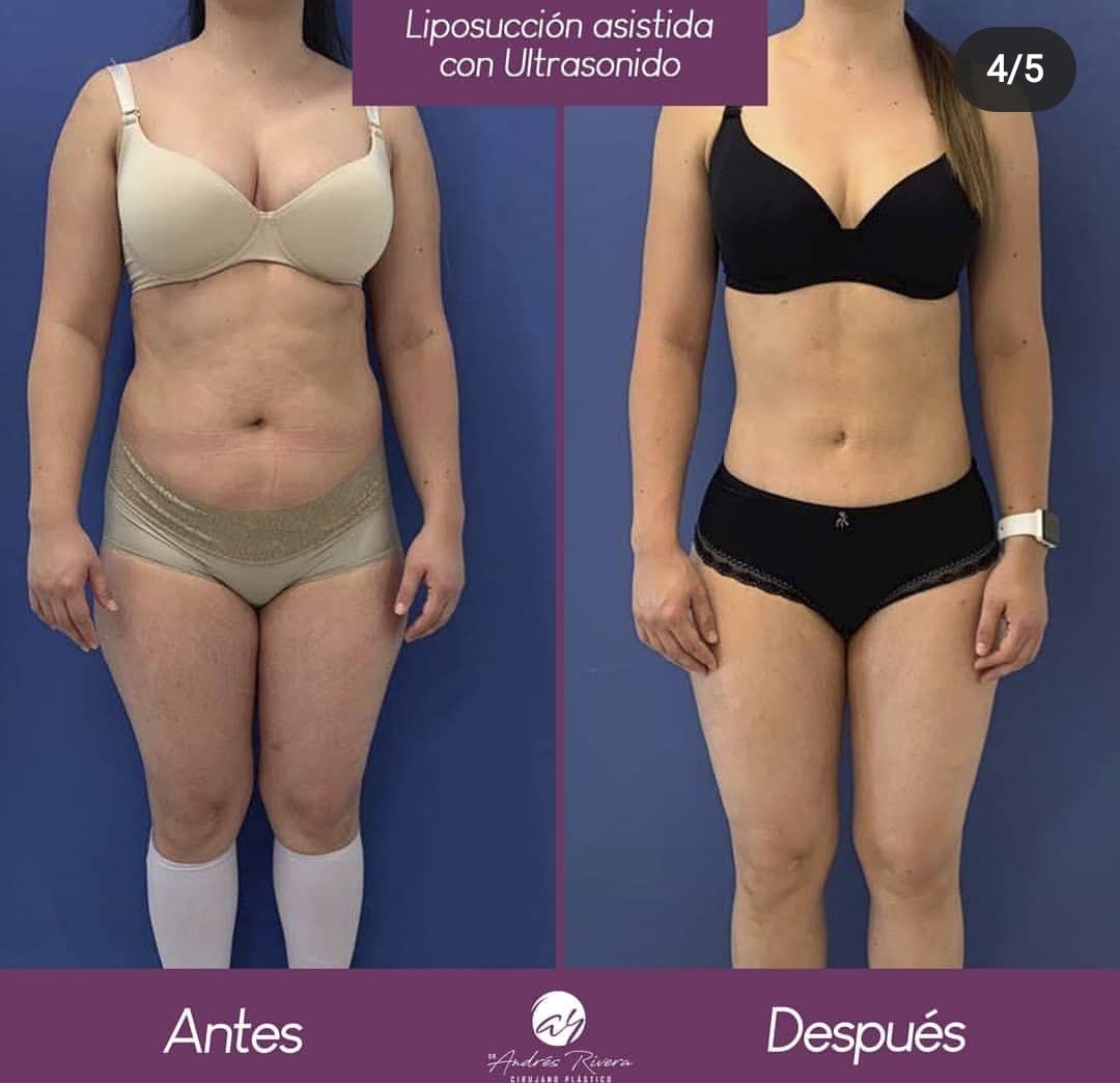 Andrés Rivera López-32