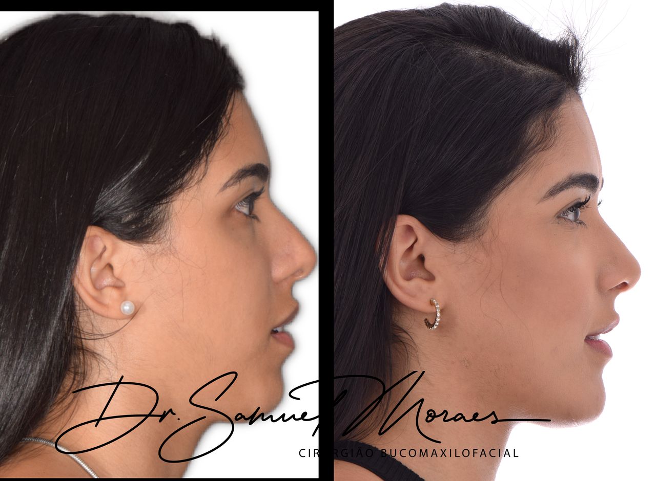 Samuel De Souza Moraes-3