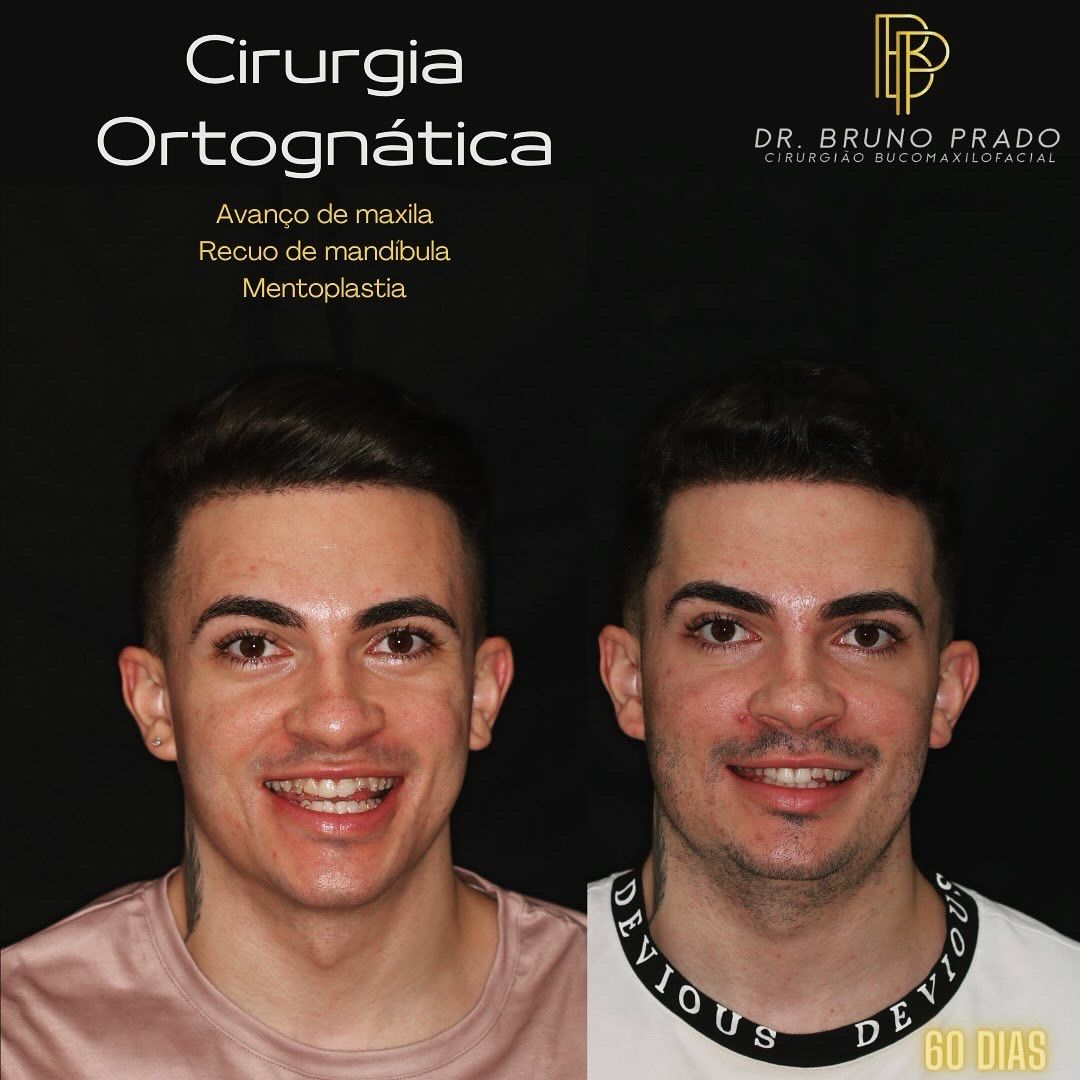 Bruno Nifossi Prado-32