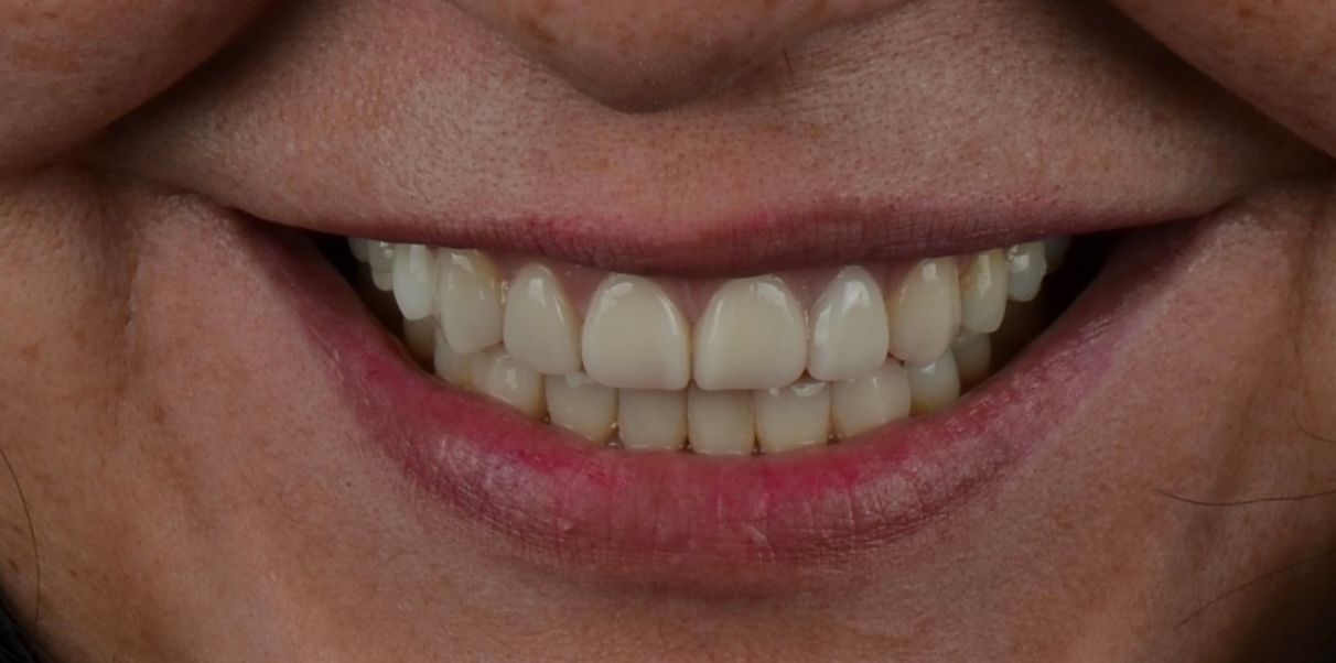 Luciano Varas Salinas-42