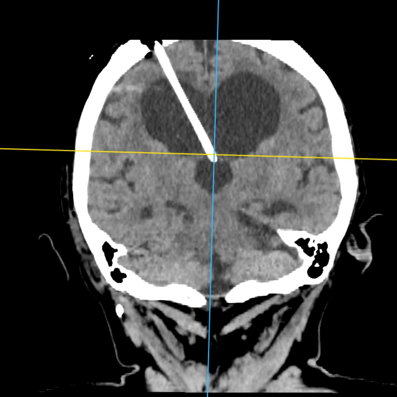David Tafur Muñoz-1993