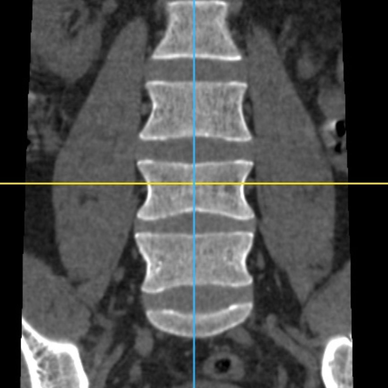 David Tafur Muñoz-1551