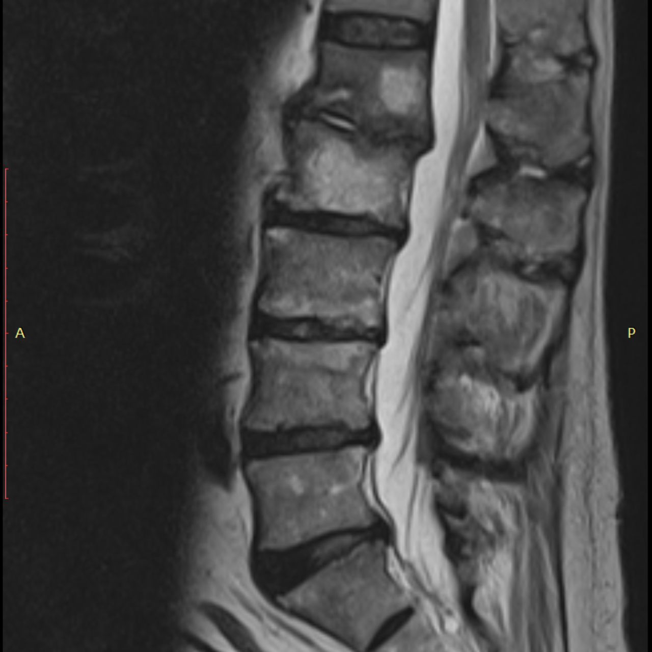 David Tafur Muñoz-1802