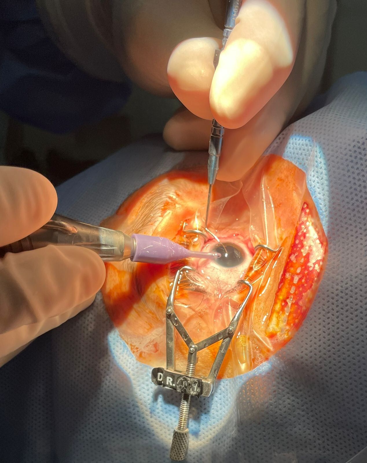 Rafael Lopes De Souza-3