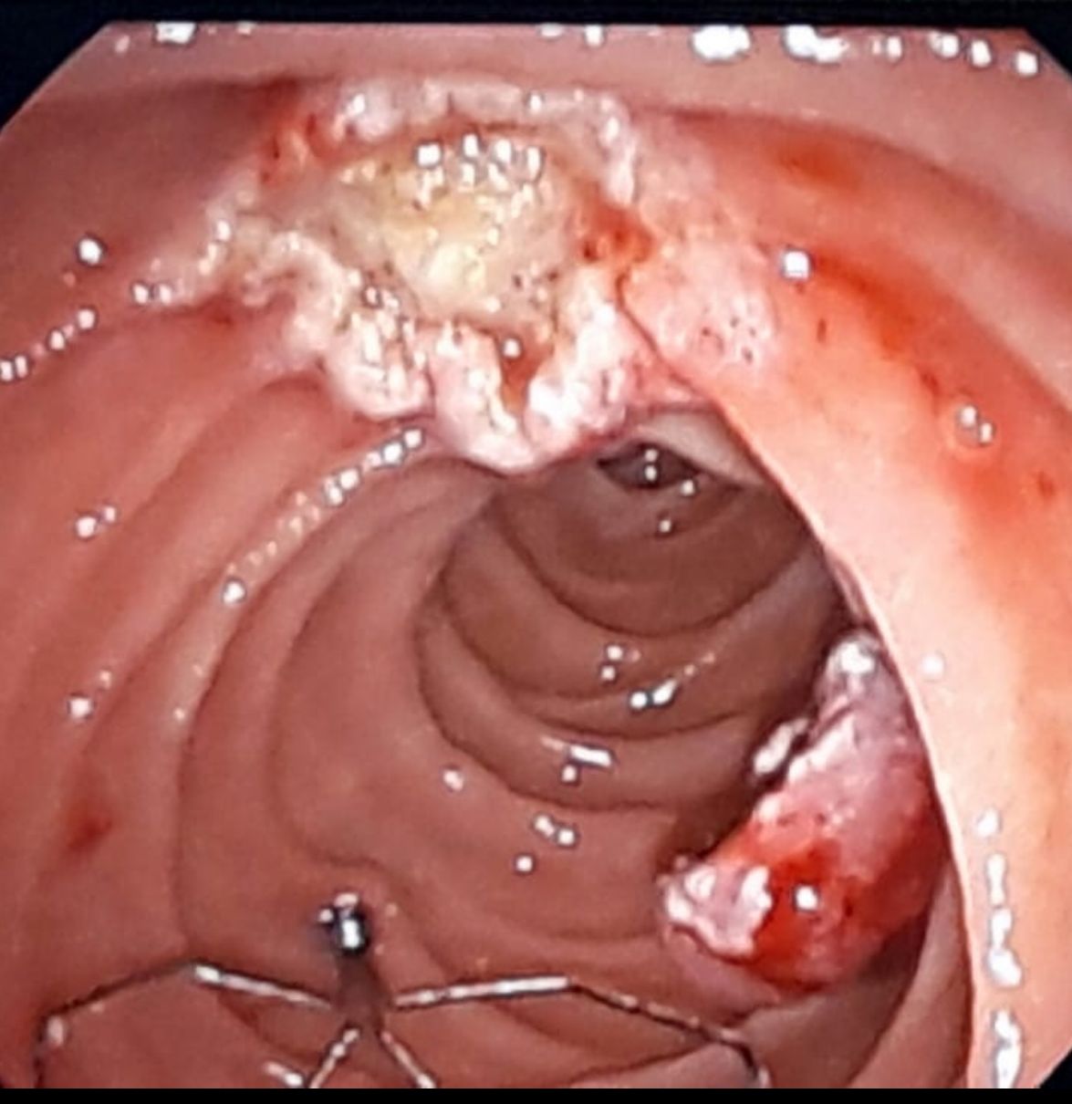 Juan Alberto Artemio Torreblanca Nava-3