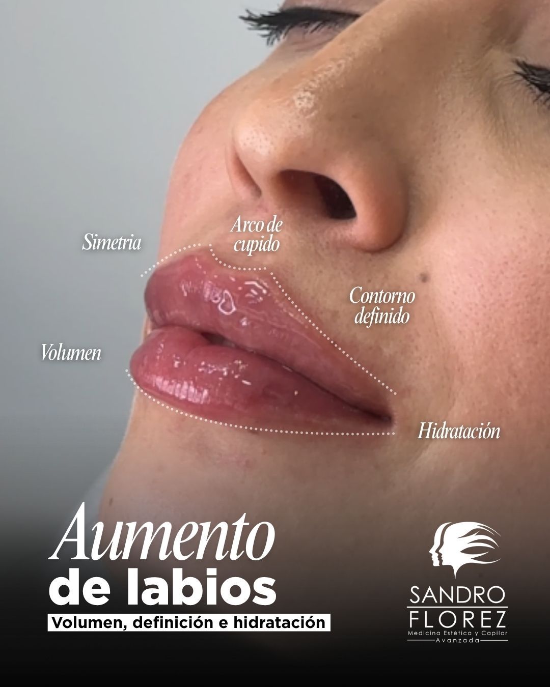 Sandro Florez-5