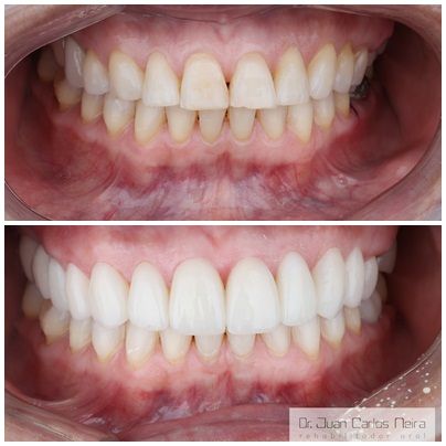 Juan Carlos Neira Rueda-16