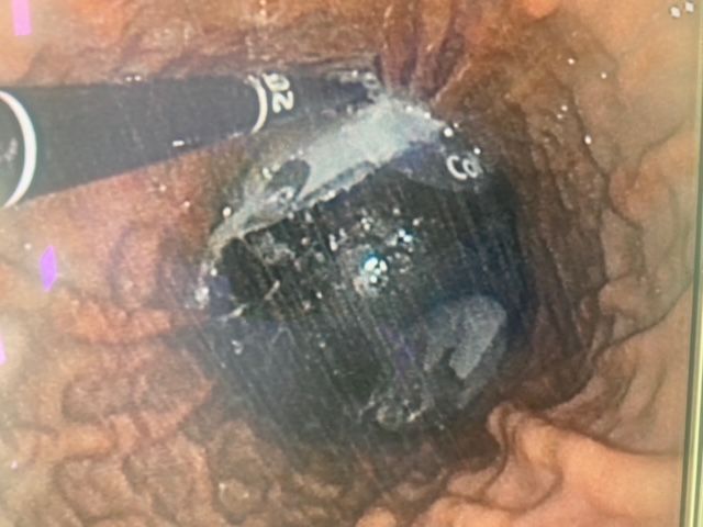 Guilherme Amadeu Poleto-51