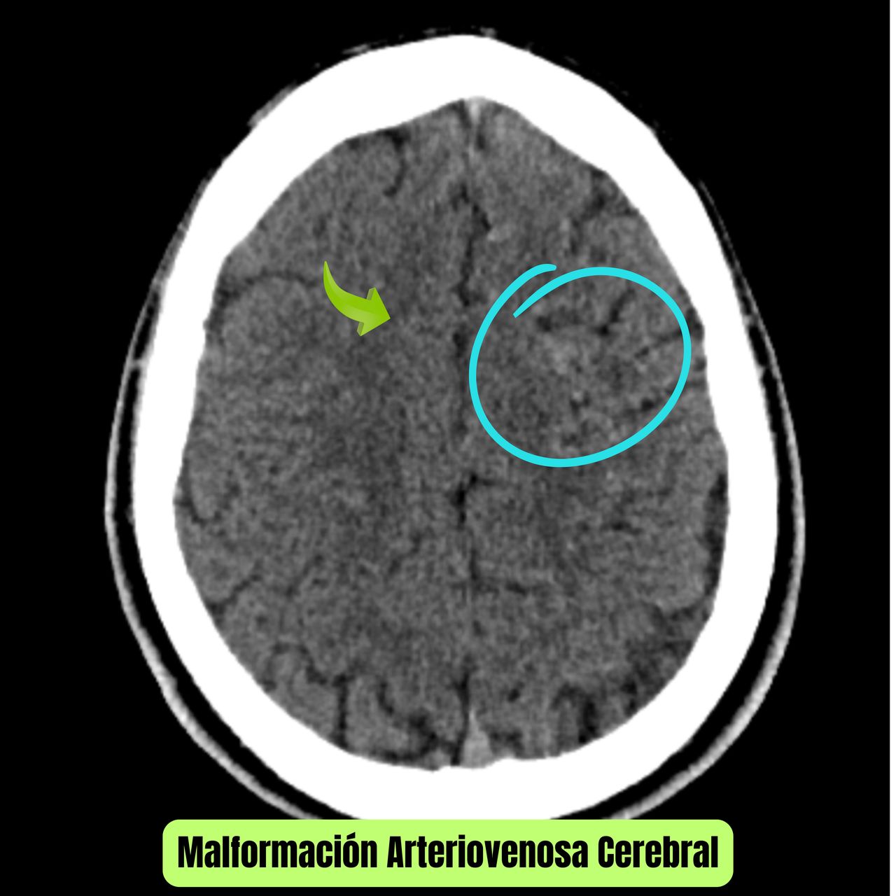 David Tafur Muñoz-2036