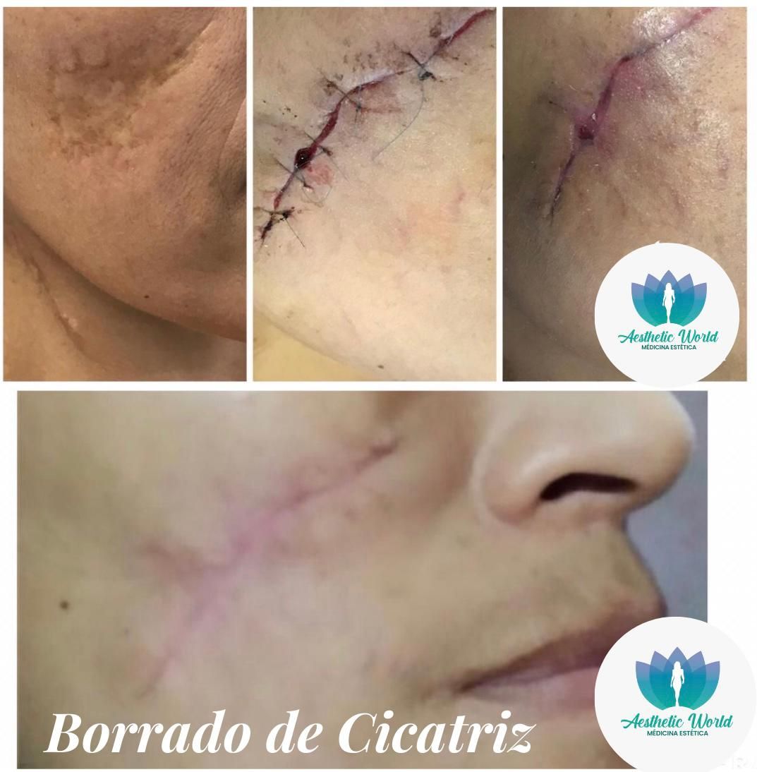 Jhonatan Oyola Farfán-12