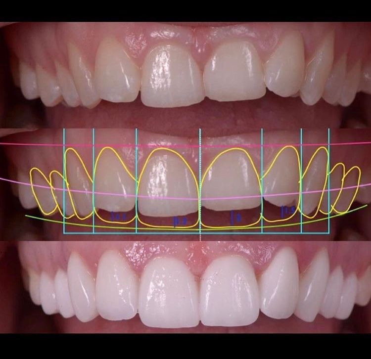 Juliana Pelegrini-11