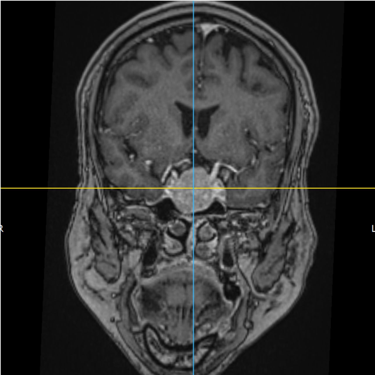 David Tafur Muñoz-1789