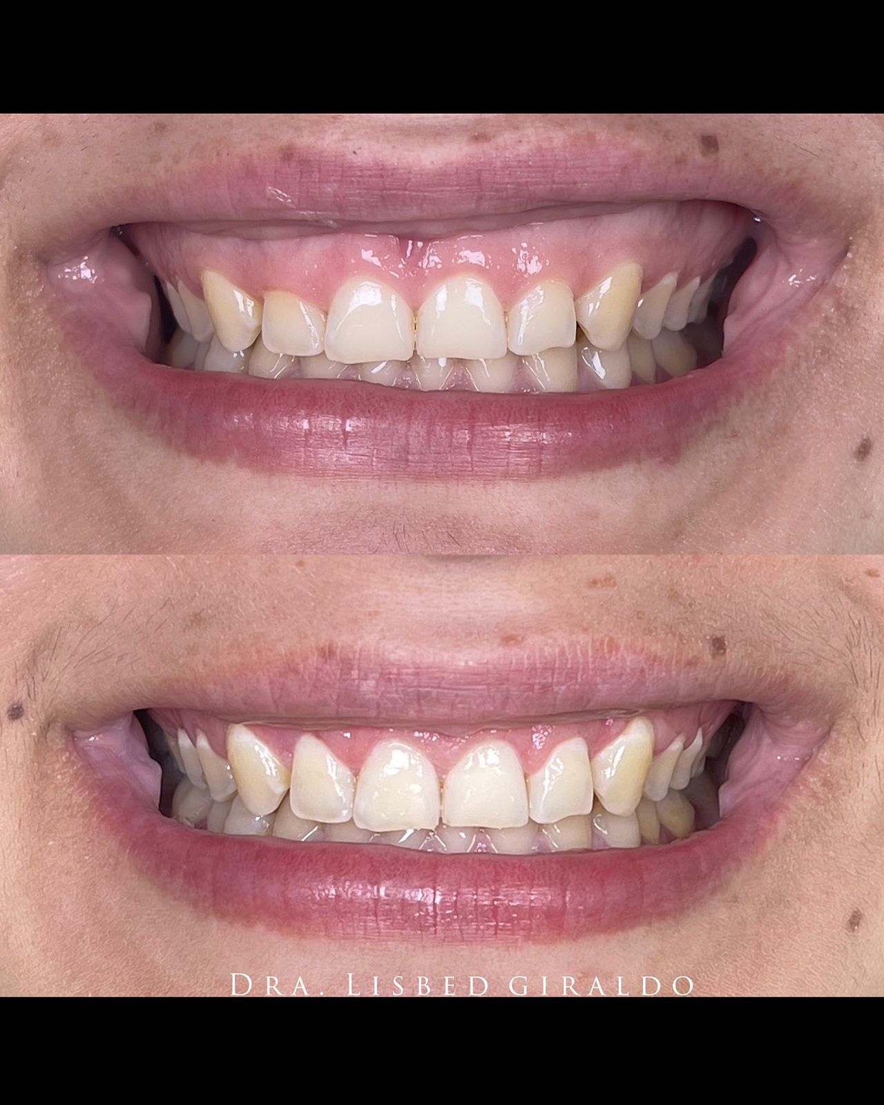 Lisbed Giraldo Olarte-9