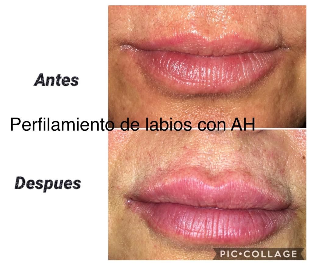 Maria Gisela Angel Losada-47