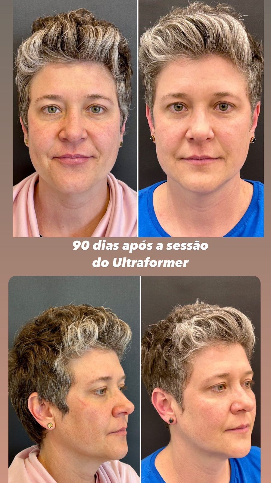 Ana Paula Stachuk-6