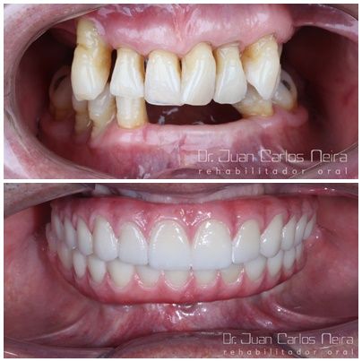 Juan Carlos Neira Rueda-19