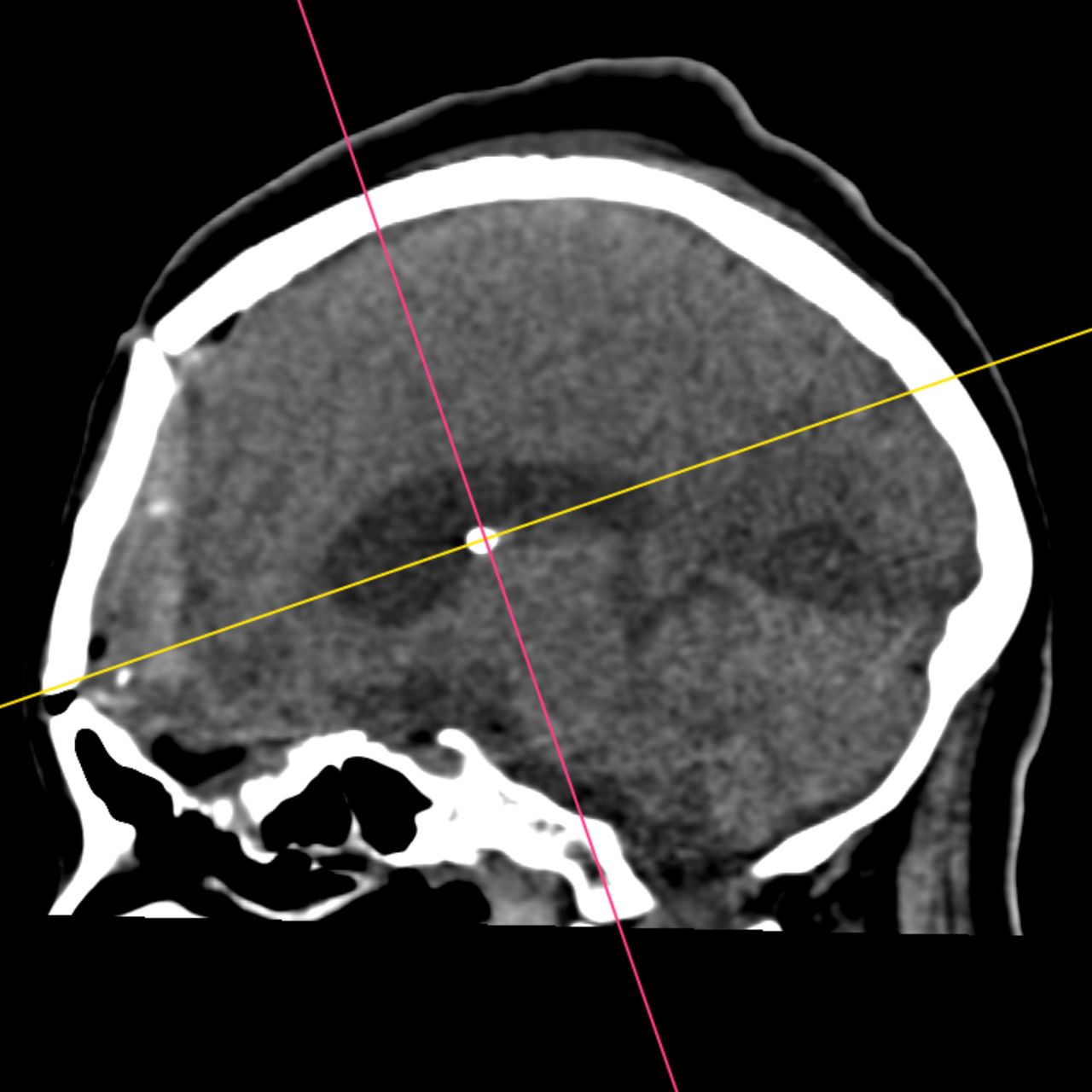 David Tafur Muñoz-1936