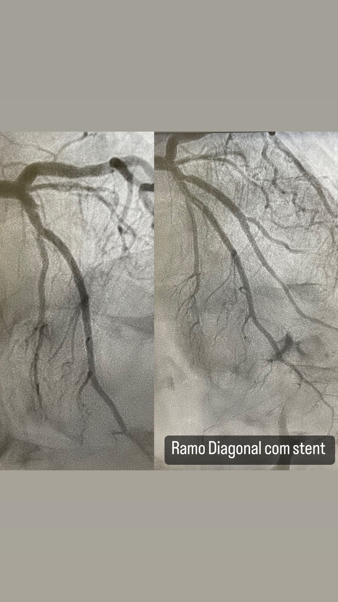 Diogo Antônio Gomes Tiago-2