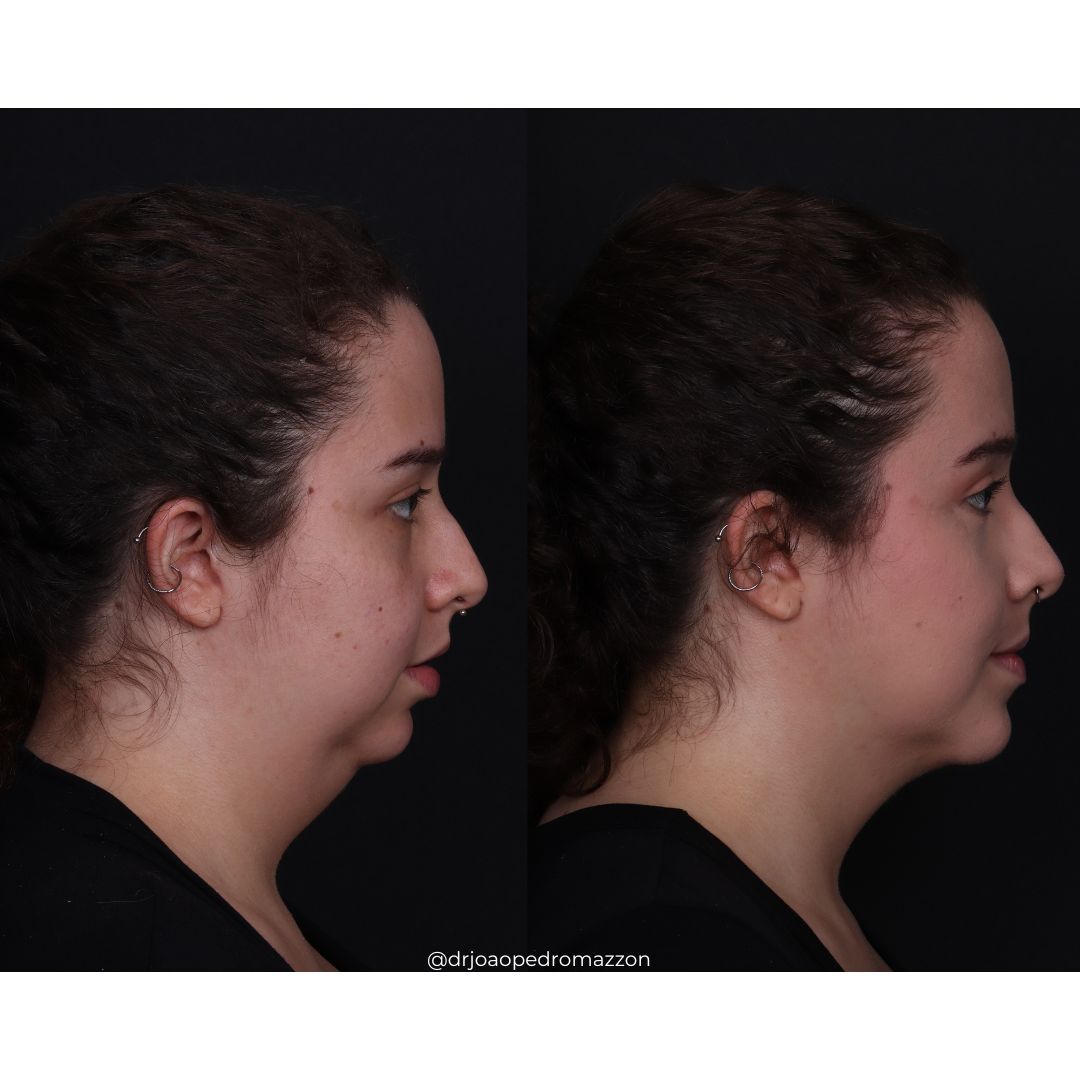 João Pedro Paulino Mazzon-28