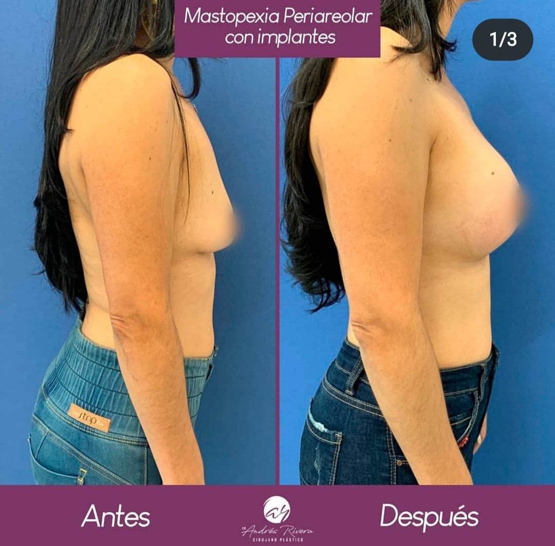 Andrés Rivera López-22